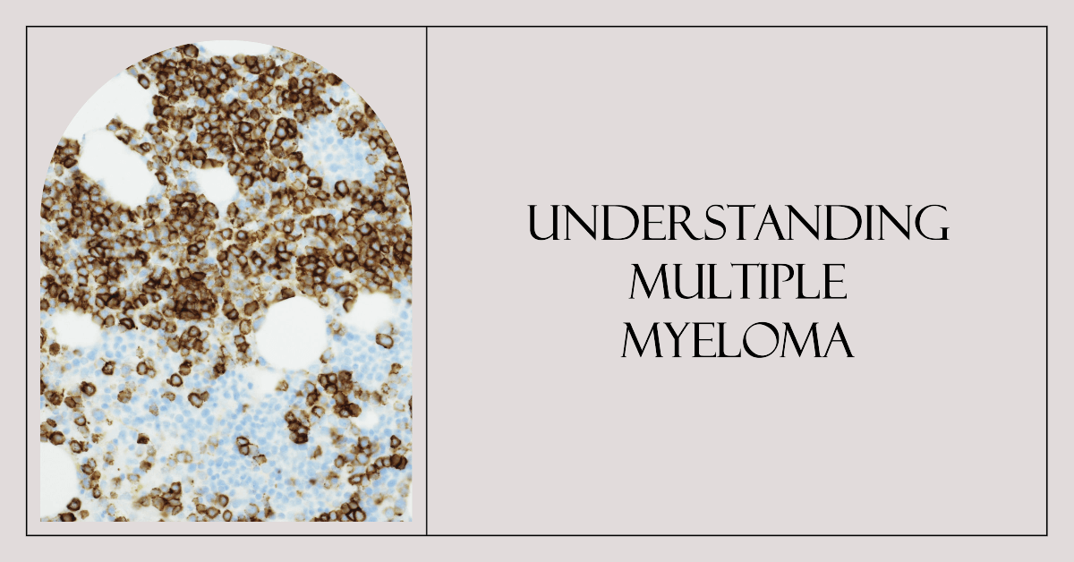 Unveiling the Silent Threat Understanding Multiple Myeloma and Its Early Signs